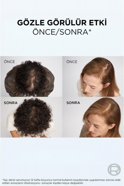 Loreal Growth Booster Saç Derisi Serumu 102 ml Saç Kremi