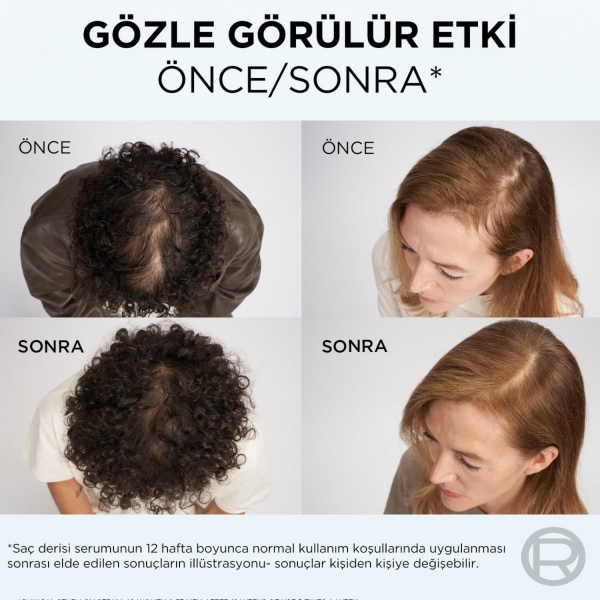 Loreal Growth Booster Dökülme Karşıtı 150 ml Saç Kremi
