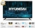 Hyundai 32HYN2100 HD Ready (HD) TV