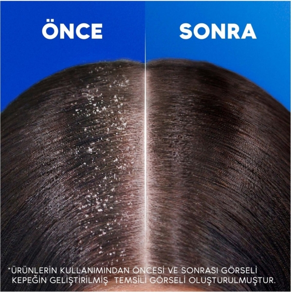 Head & Shoulders Nemlendirici Bakım Kepeğe Karşı Etkili 330 ml Şampuan